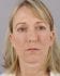 Face Lift Patient 10 - After Thumbnail 