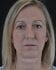 Face Lift Patient 10 - Before Thumbnail 