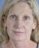 Face Lift Patient 17 - Before Thumbnail 