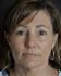 Face Lift Patient 25 - Before Thumbnail 