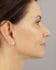 Face Lift Patient 36 - After Thumbnail 