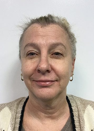 Photofacial 02 - After Thumbnail