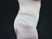 Tummy Tuck Patient 22 - After Thumbnail 
